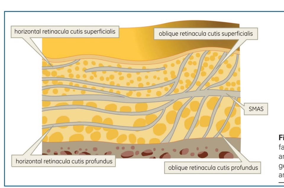 水平與斜向 Retinacula Cutis Superficialis 與 Profundus 解剖示意圖